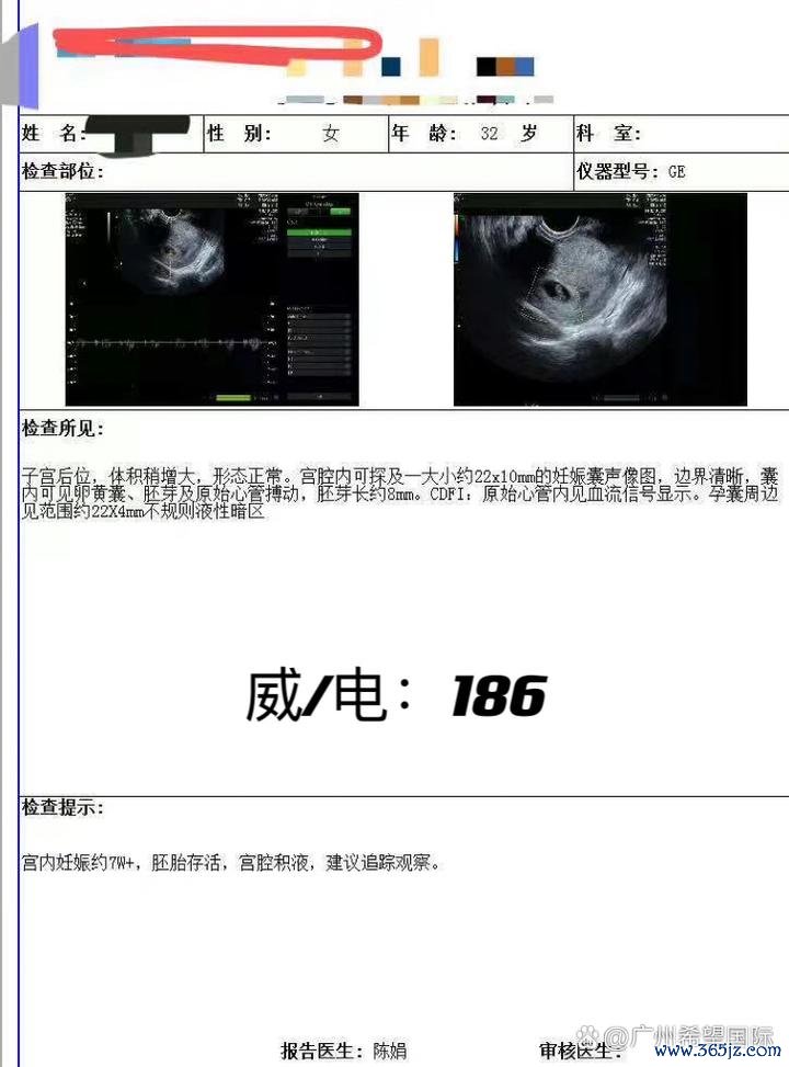 北京捐卵价格透明解析与影响因素揭秘